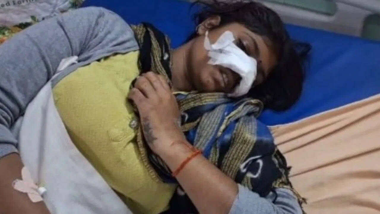 Woman prevented drinking alcohol, an angry drunkard sliced ​​nose with a knife