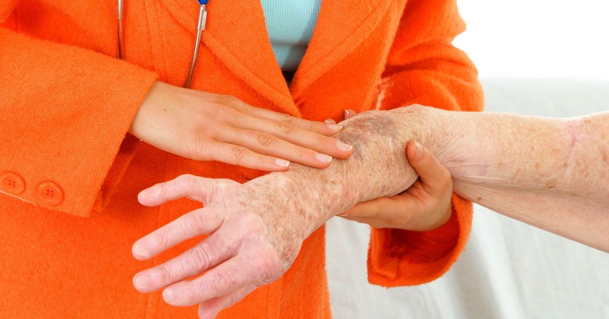 A study that reveals: “Zombie” cells can help treat cancer