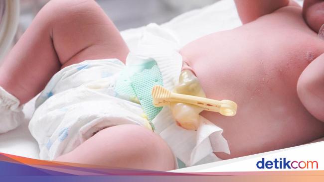 Bogor founders found a baby girl in Saung, who was allegedly born