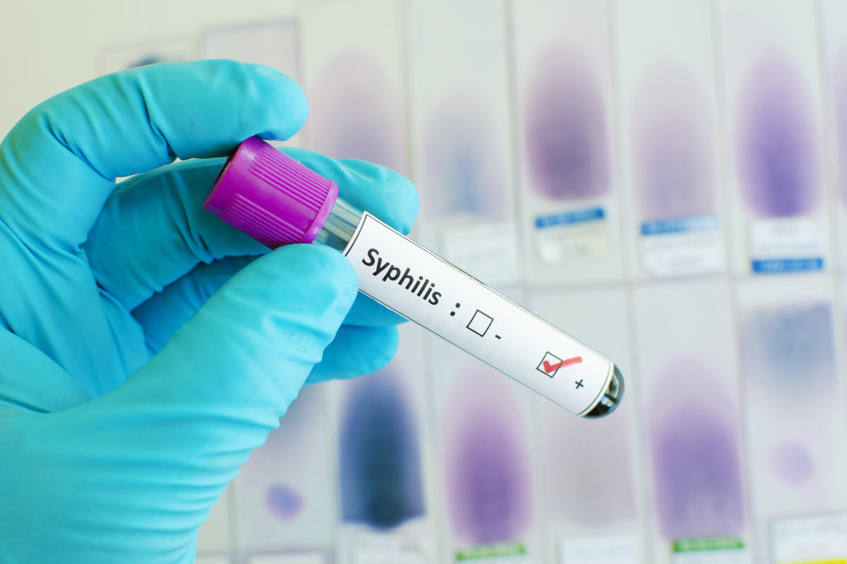 Syphilis caes are on the rise. The fda just approved a home test that coulud combat that. – ryan