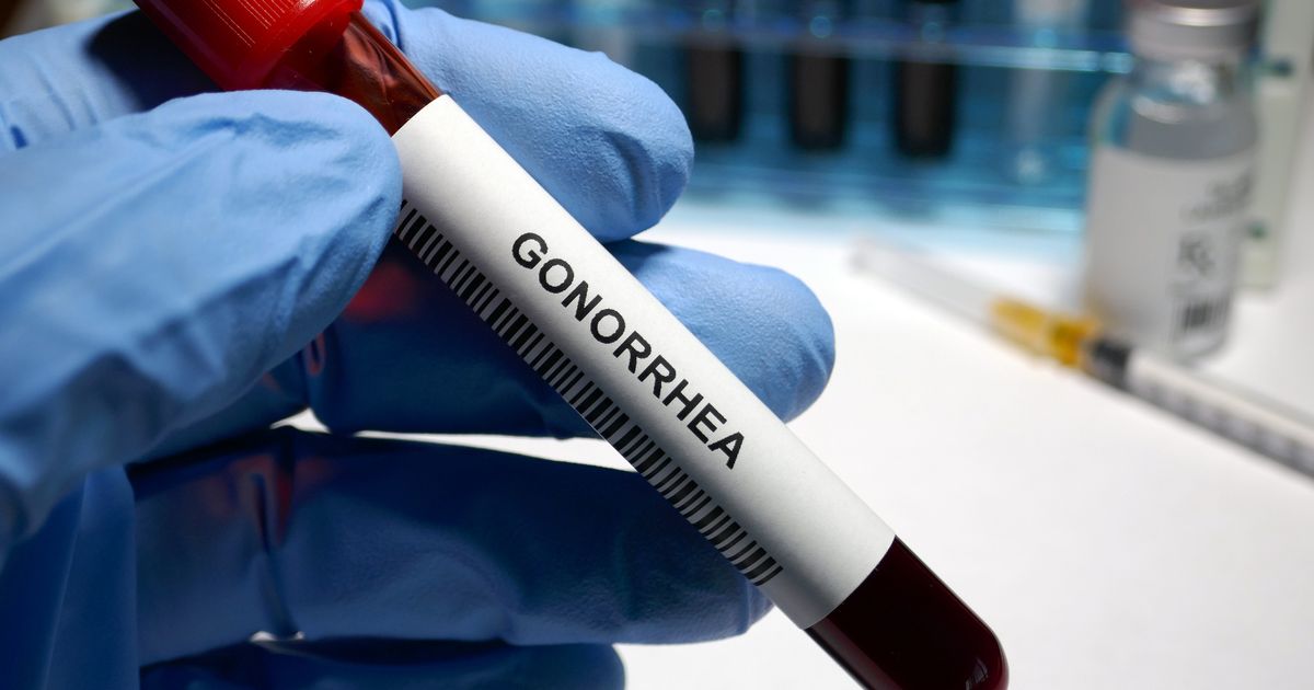 gonorrhoea-warning-signs-you-must-know-amid-big-tension-alert-and-vaccine-opinion