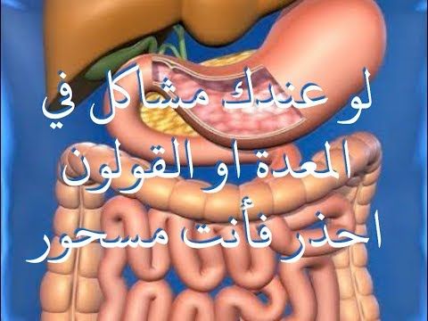 كيف-اخ-educ-الم-القولون-–-لاينز