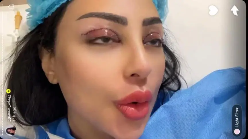 بعد خضوعها لعملية تجميل في جفن العين، ريماس منصور تطل على متابعيها من غرفة الإفاقة، وتوجّه…