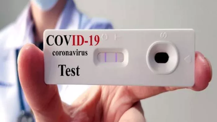 Himachal News: Lacker Administration Alert to Corona distributed in the country, 500 test sets ordered in Bilaspur – Bilaspur Health Department prepares for Coron Coron Carss Surge Orders 500 Tests Kits Kits