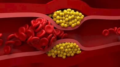 4-أطعمة-تناولها-ليلا-تقلل-مستويات-الكوليسترول-في-الدم