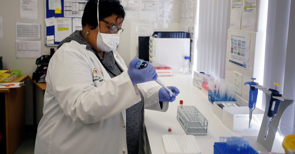Researchers invented a technique to diagnose tuberculosis faster