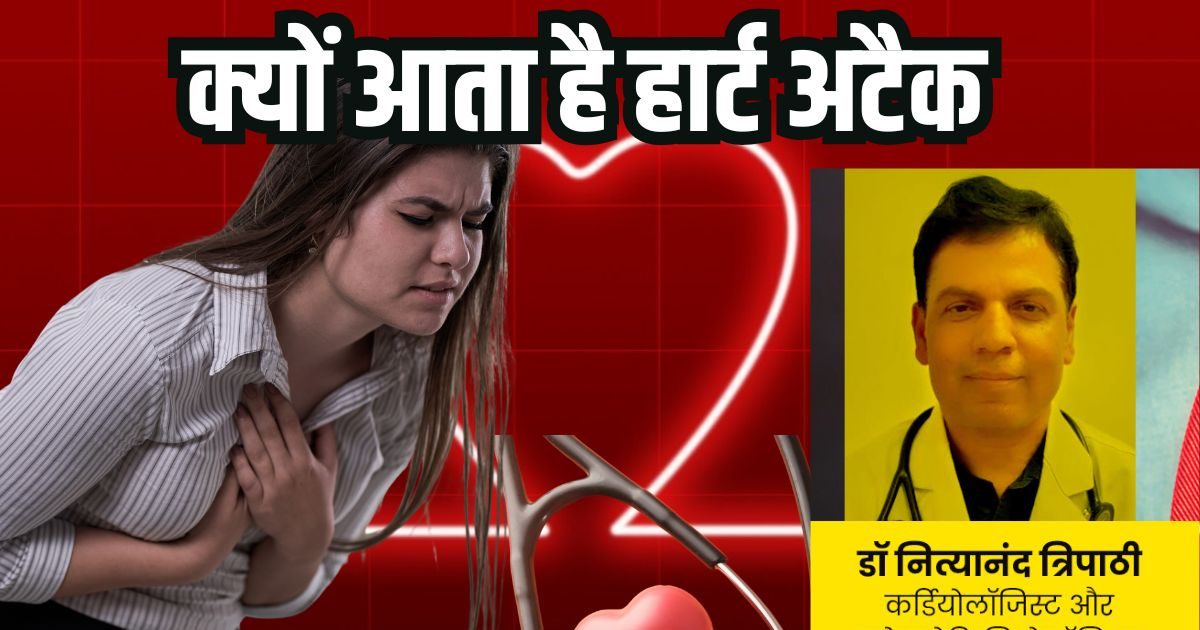 What is a heart attack? What is the reason? When you have to look to avoid it, know everything about a cardiologist