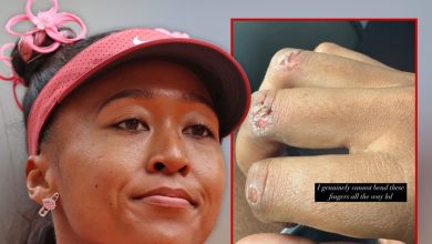 naomi-osaka-reveals-off-gnarly-blisters,-opens-up-on-wanting-tennis-spoil