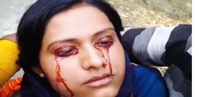 Blood comes from the woman’s eyes, husband left as ‘witch’