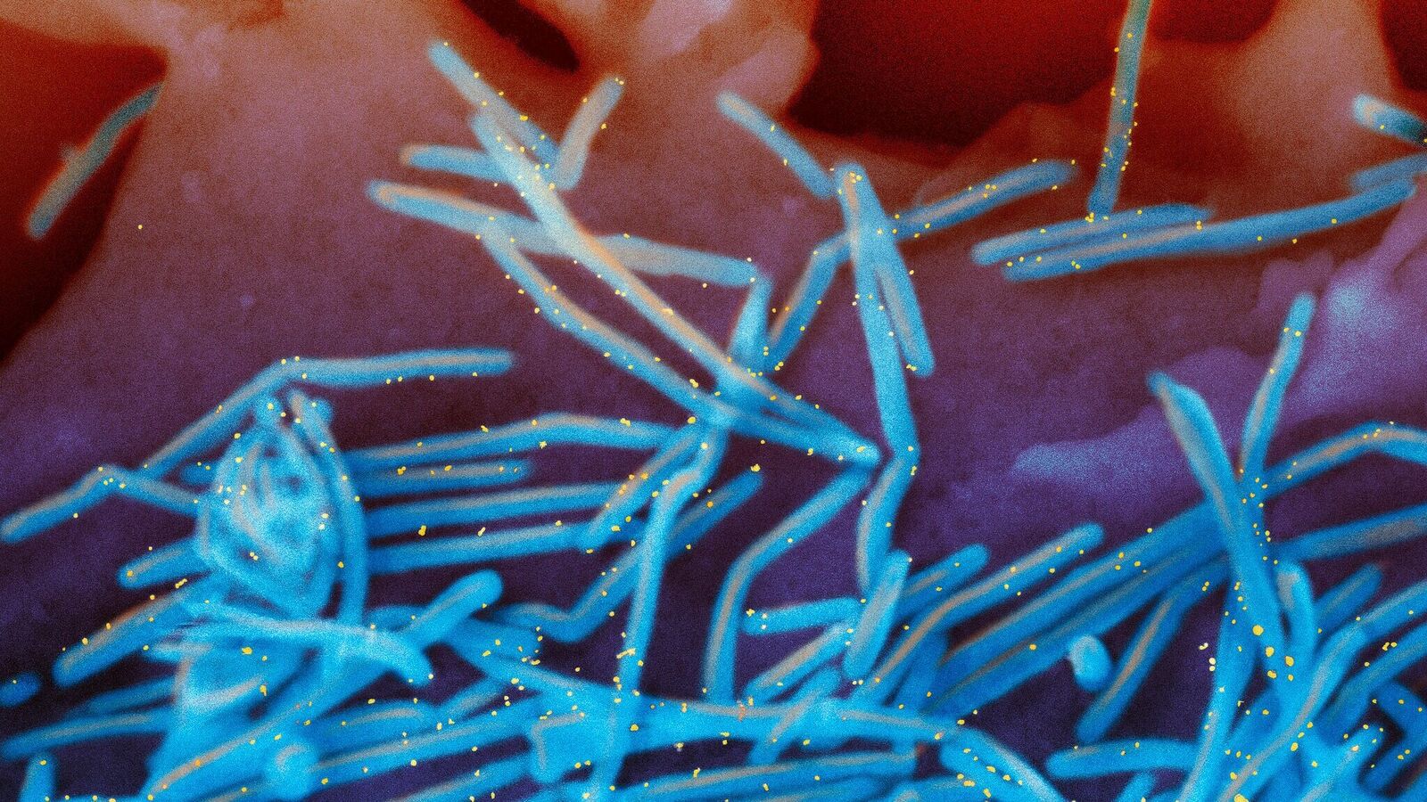 ‘AgroERRORISM WEAPON’: How China-linked outbreaks disrupted life worldwide | Today news