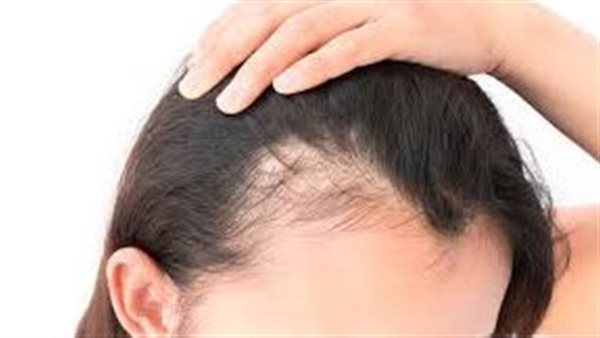 أفضل زيت لإنبات الشعر وتكثيفه من أسرار الطبيعة – ryan