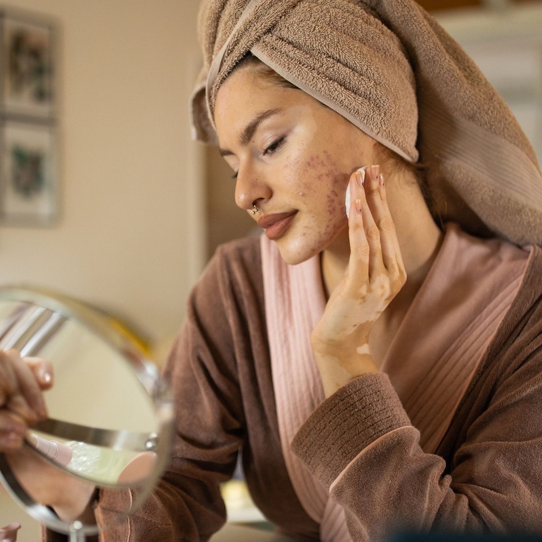 WHY YOU GET ACNE ON PLANES AND WHAT DERMATologists Recommend – ryan