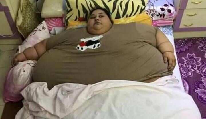 The world’s heaviest wife decreased 100 kg after surgery