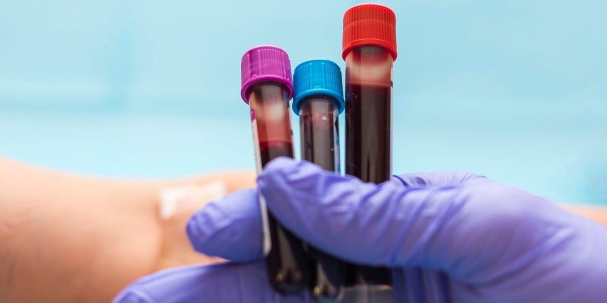 New $ 800 Blood Test Measuring Proteins to Reshape Longevity and Personalized Medicine – ryan