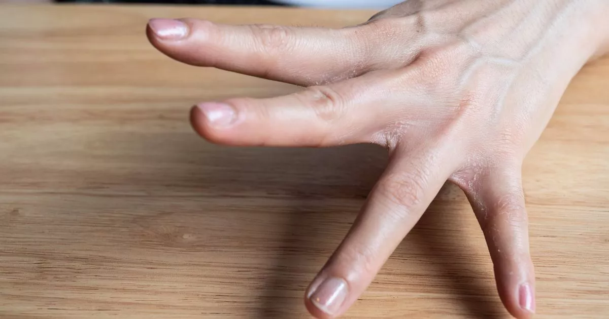 LUNG CANCERS DOCORS SAY EARLY SIGN OF DISEASE CAN APPEAR ON YOUR Fingertips – ryan