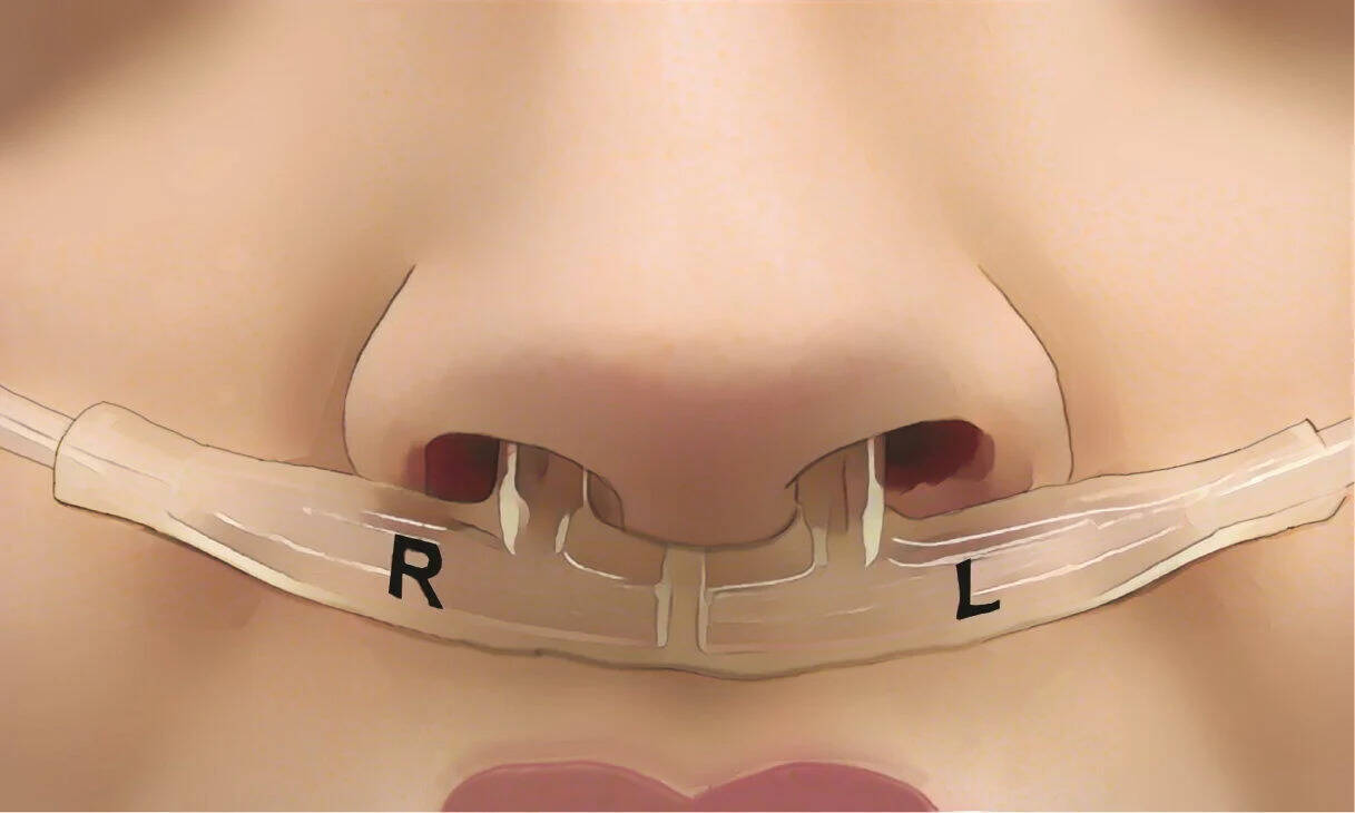 Without blood, without scan … Now your breath will manage the whole state of health! Scientists have unveiled