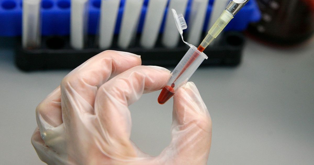 A new medicine composition can succeed in treating “acute leukemia”