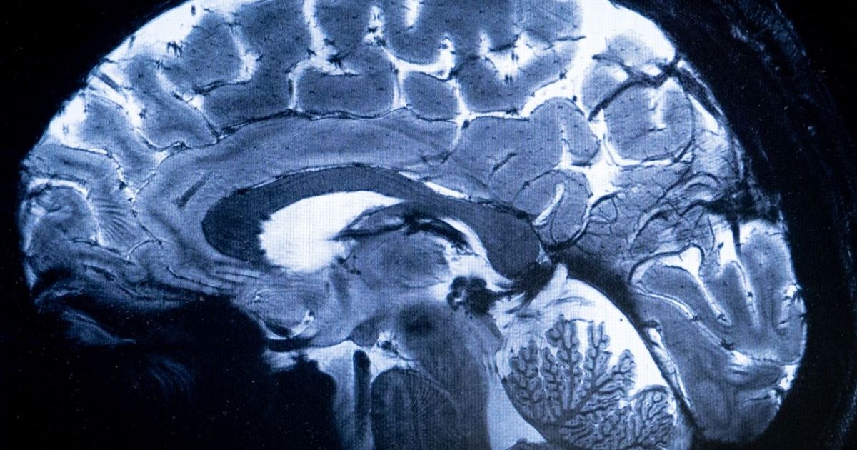 China competes with the United States successfully the first experiment that has planted a slide in the brain