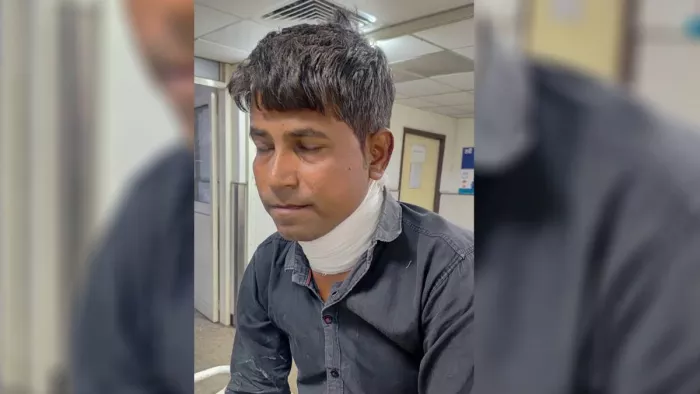 The father did the fan, the children suddenly suppressed the switch; Cut Neck – Panipat News Father Durvured while the recovery of the fan kid turns on