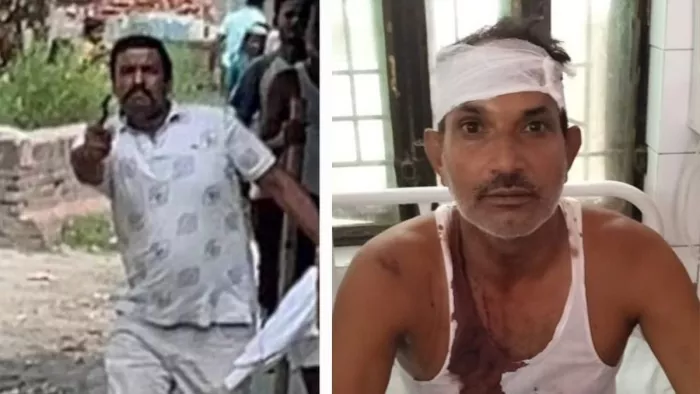 UP Mango’s: Indiscriminate bullets in UP over mangoes, four in custody, including Pradhan – Mango – dispute the allegation of the firing of Pradhan in detention