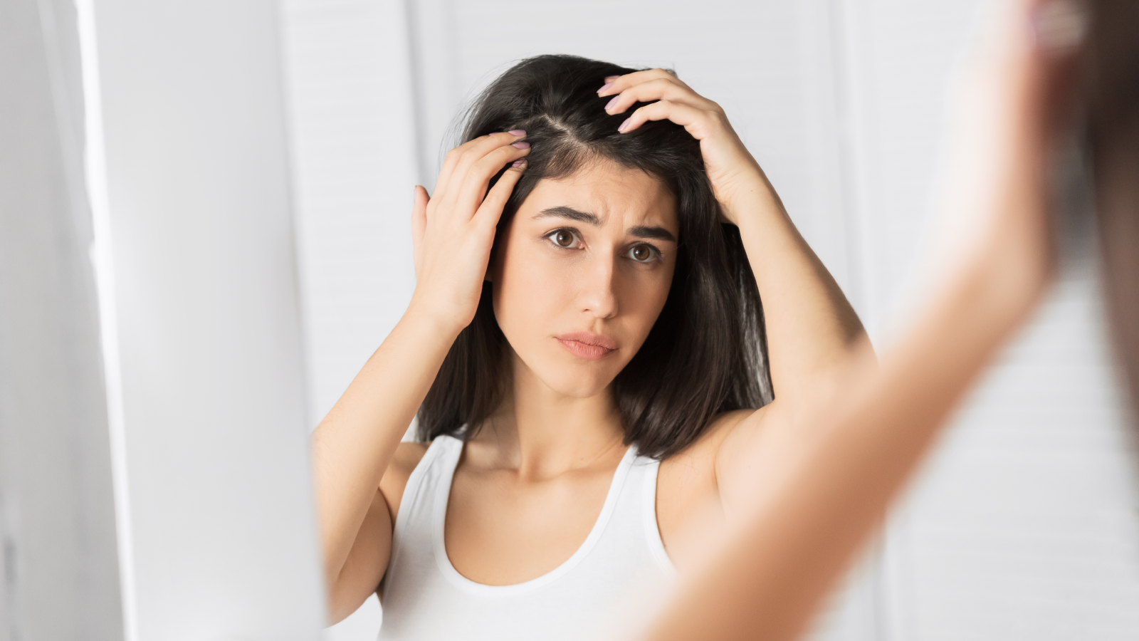 علاج-قشرة-الرأس-نهائيًا-بوصفات-منزلية-طبيعية