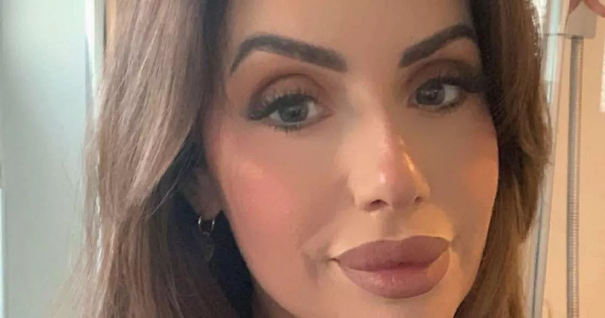 ‘my-husband-squashed-my-face-to-burst-my-filler-so-i-couldn’t-look-other-for-other-men’