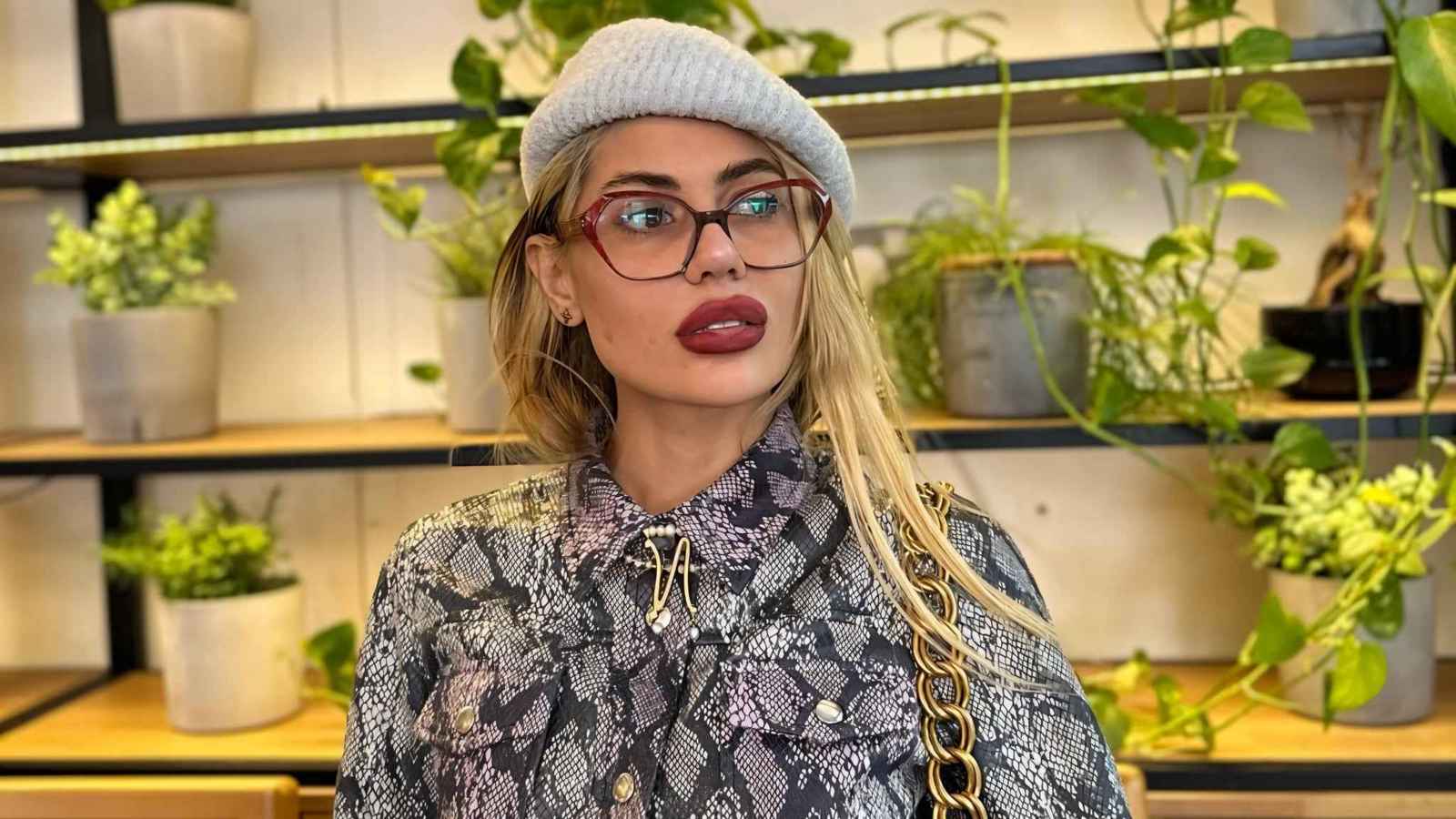 the-loss-of-traipse-for-food-ends-the-existence-of-a-turkish-actress-…-and-her-neck-screams