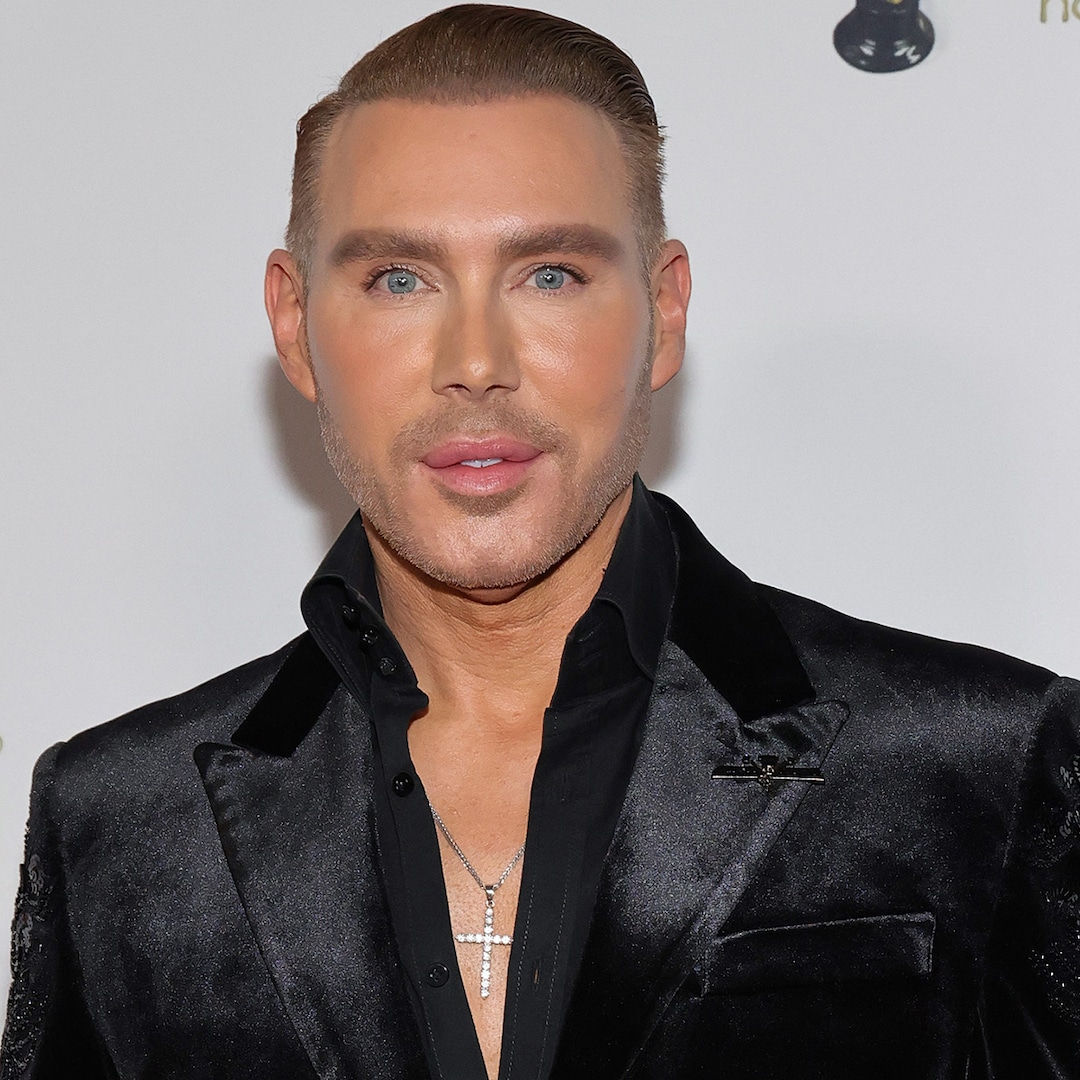 makeup-artist-kristofer-bukle-revells-plastic-surgical-scheme-turn-out-to-be
