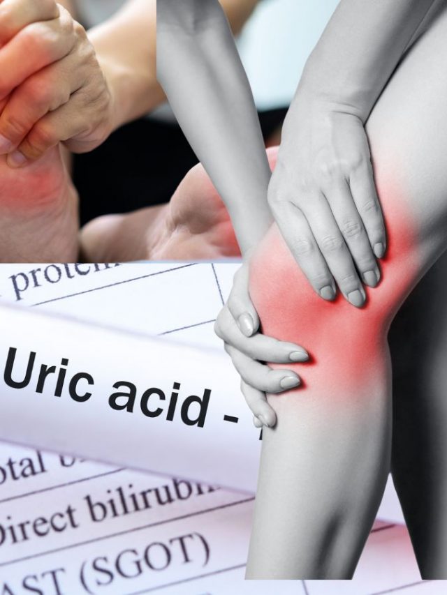 7 Signs of uric acid increase