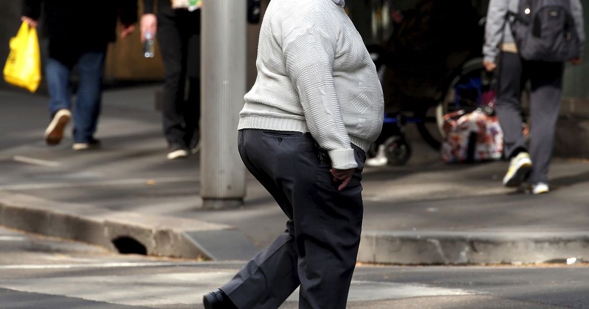 Study: Long -term obesity accelerates biological aging among young people