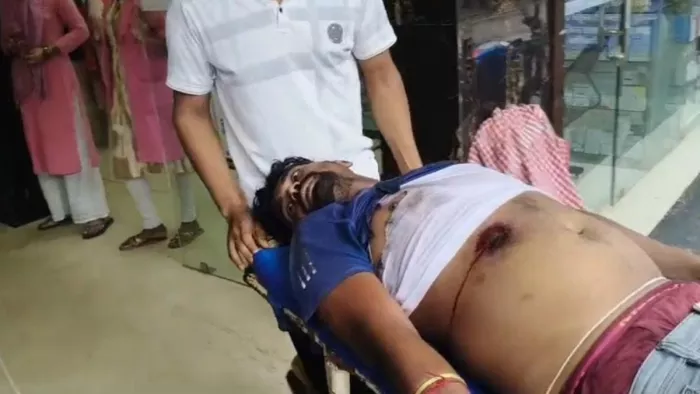 When he refused to give a bicycle to carry alcohol in Begusarai, the boy shot the father in the stomach – in Begusarai the boy shot his father in the stomach because he refused to give him the bike to wear drink