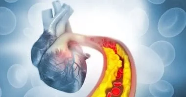 ابدأ يومك بهذه الأطعمة لتقليل الكوليسترول وتعزيز صحة القلب