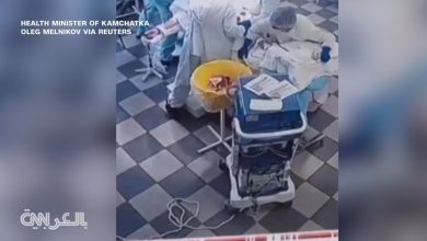 أطباء يجرون عملية جراحية أثناء زلزال في روسيا