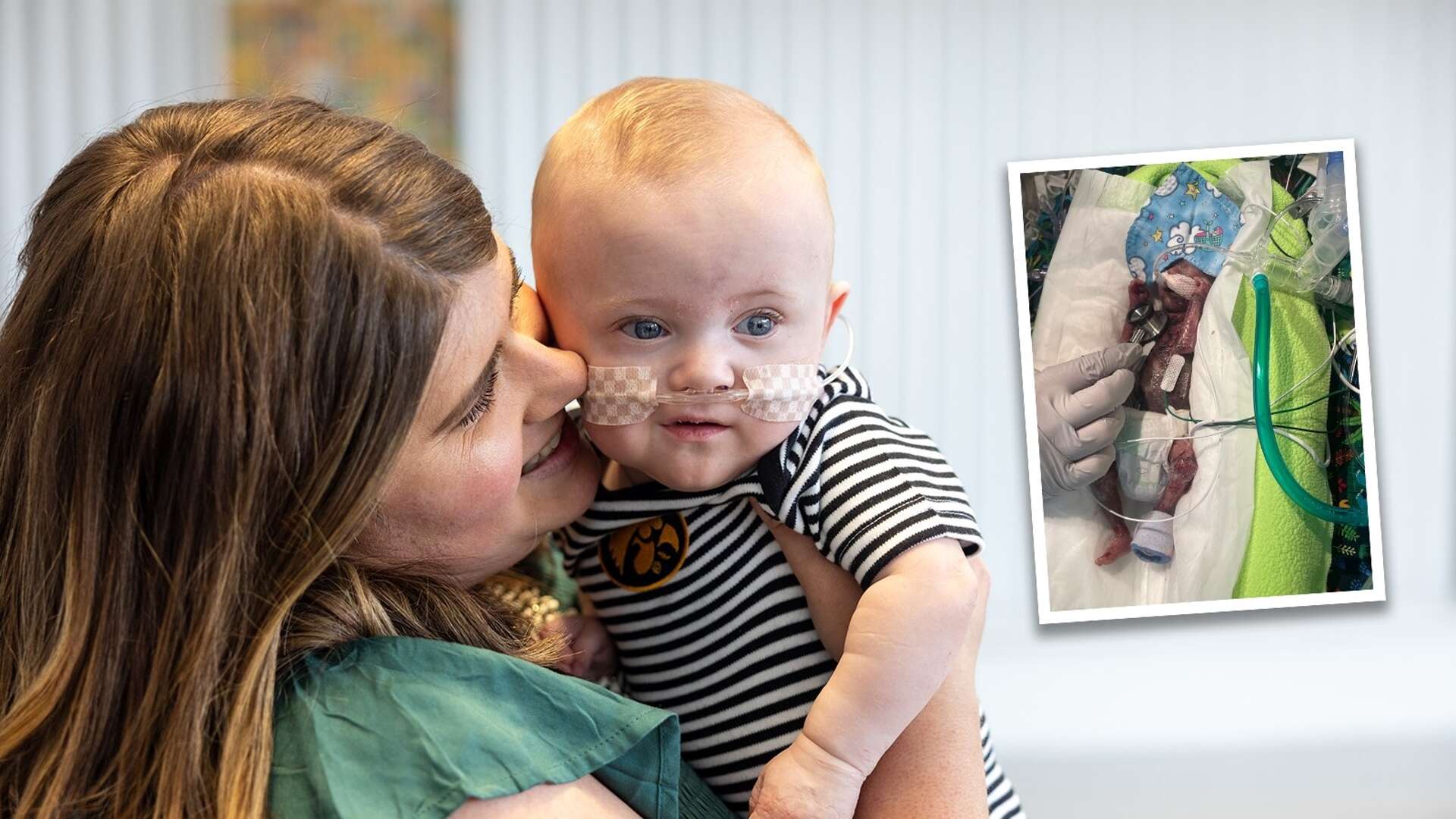 Example of wonderful life! The illusion of medical science was born in just 21 weeks and broke the confusion of medical science, made the Guinness World Record