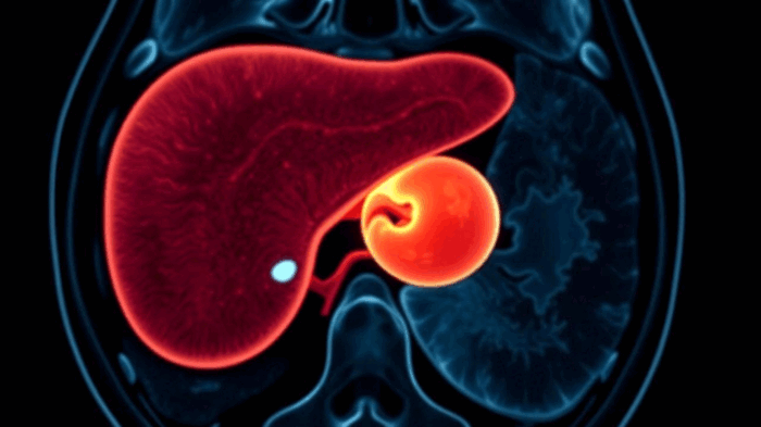 Case shocking medical science in lake: 12 weeks fetus developed in the woman’s liver
