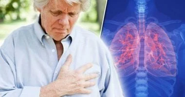 اليوم العالمي لسرطان الرئة.. ليس المدخنون وحدهم معرضون له وأسباب الخطر غير الظاهرة