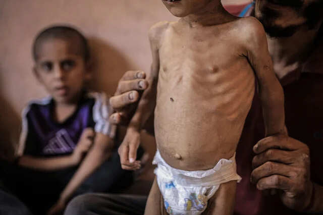 Innocent in the cracks of hunger, fear and death … heart will cry after seeing pictures of children coming from the streets of Gaza