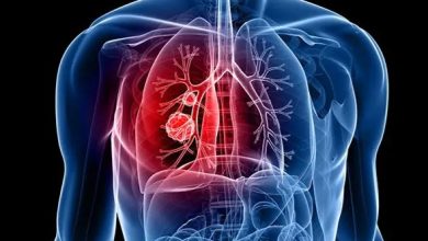 8 ways to keep the lungs healthy