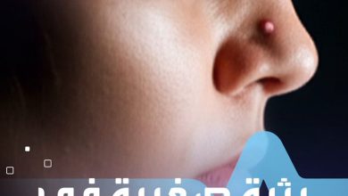 بثرة صغيرة في وجهك بمنطقة “مثلث الموت” قد تسبب إصابتك بالعمى! صحة _صحة