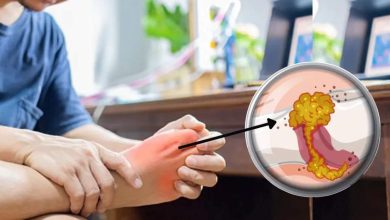 The doctor said this drink will be wiped out within 21 days, wiped out uric acid, drinking on an empty stomach every morning
