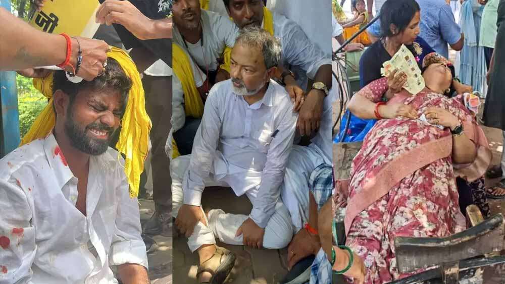 Police are ruining about the peaceful performance of Jan Suraj! Many workers were seriously injured in Lathicharge, viral video of Clash