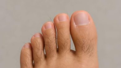 Hair is on toes! Is it good or bad? Learn how their happiness is there?