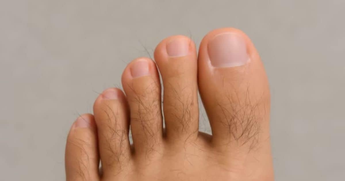 Hair is on toes! Is it good or bad? Learn how their happiness is there?