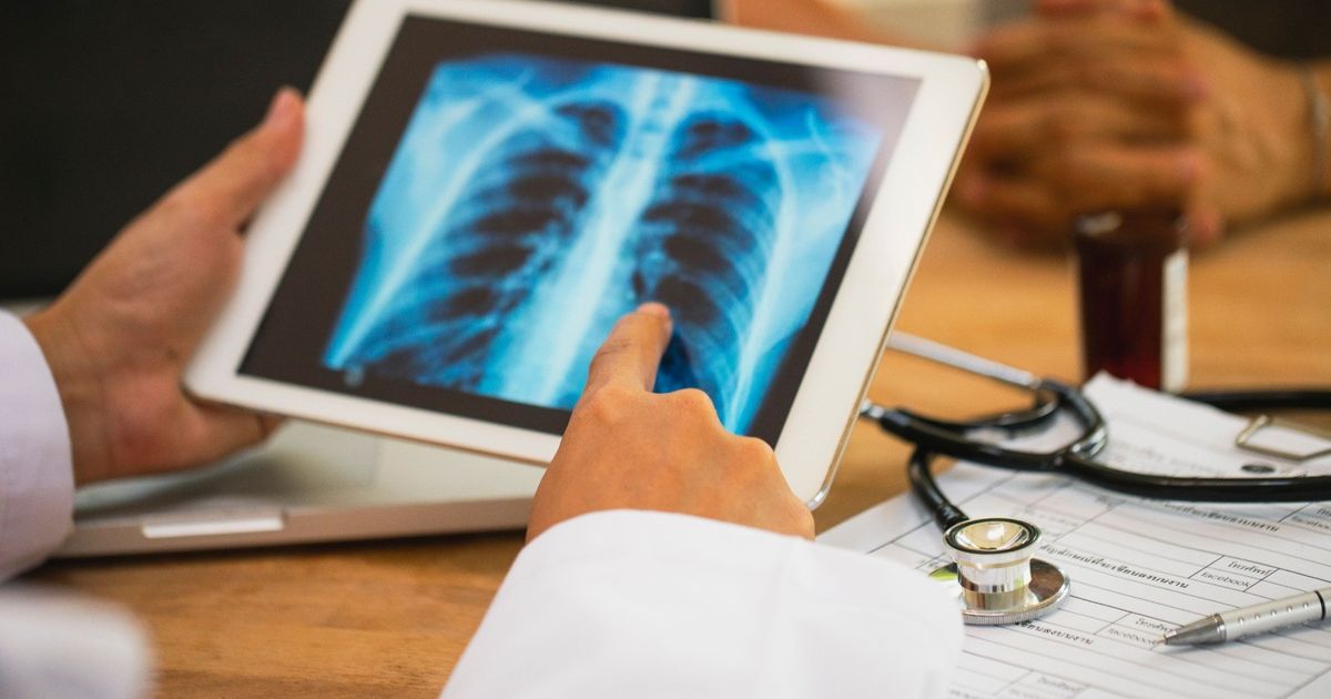 An interactive electronic tool that can help reduce deaths to lung cancer