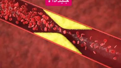 هل تعلم ان جلطة الشرايين المفاجئة ممكن تصيب حتى الاشخاص الذين يظنون نفسهم بصحة جيدة