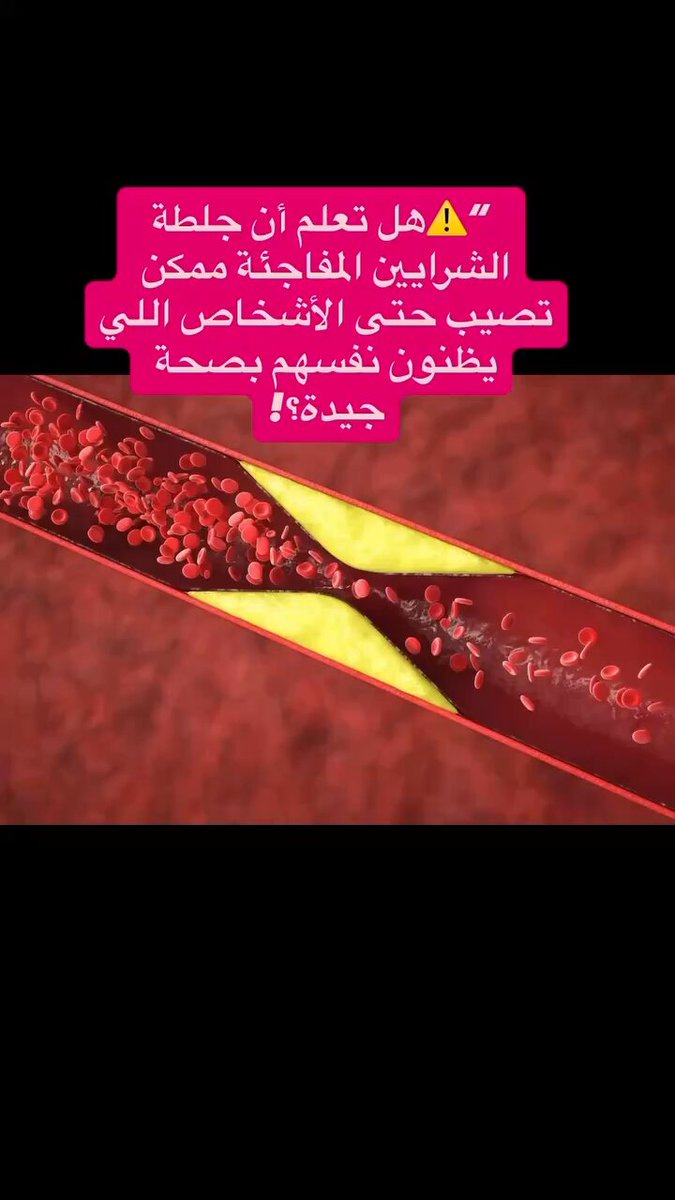 هل تعلم ان جلطة الشرايين المفاجئة ممكن تصيب حتى الاشخاص الذين يظنون نفسهم بصحة جيدة