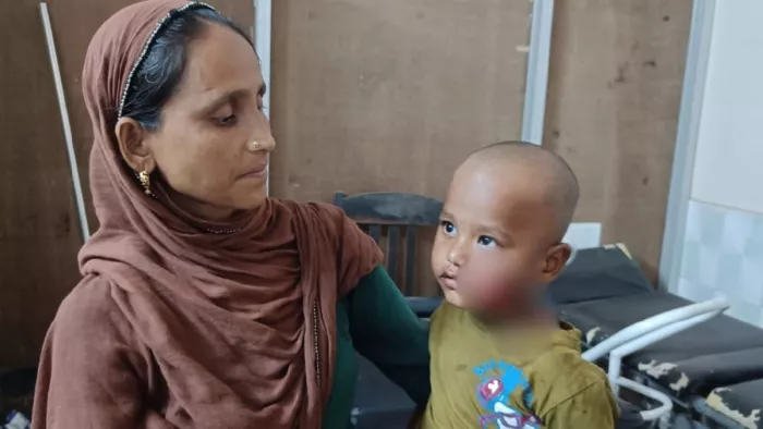 The attack of stray dogs does not stop, two and a semi -year -old child playing in Doghar will be shown; Mother saved life – stray dog -attacks child in Doghar crack panic
