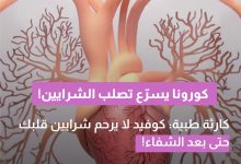 باحثون: حتى الإصابة الخفيفة بكورونا قد تسرّع تصلب الشرايين