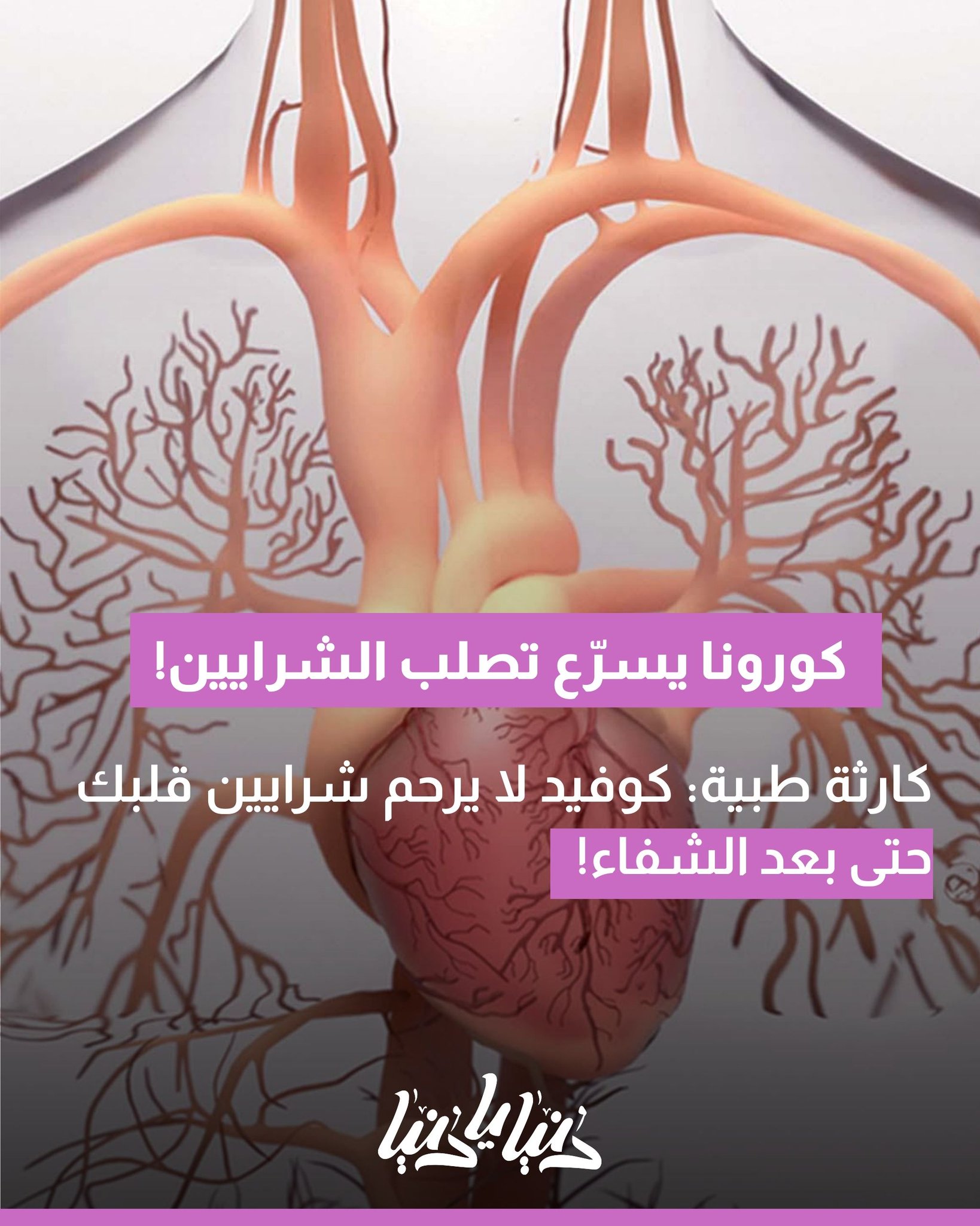 باحثون: حتى الإصابة الخفيفة بكورونا قد تسرّع تصلب الشرايين