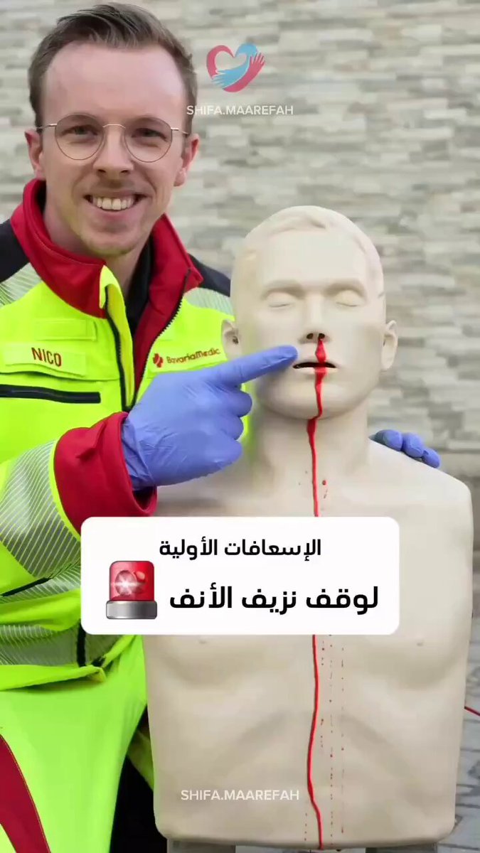 الإسعافات الأولية لوقف نزيف الأنف